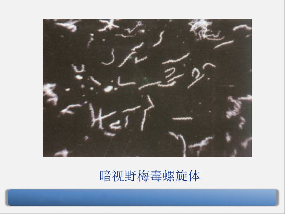 梅毒的诊断与治疗PPT课件下载(共90页·可编辑修改)5
