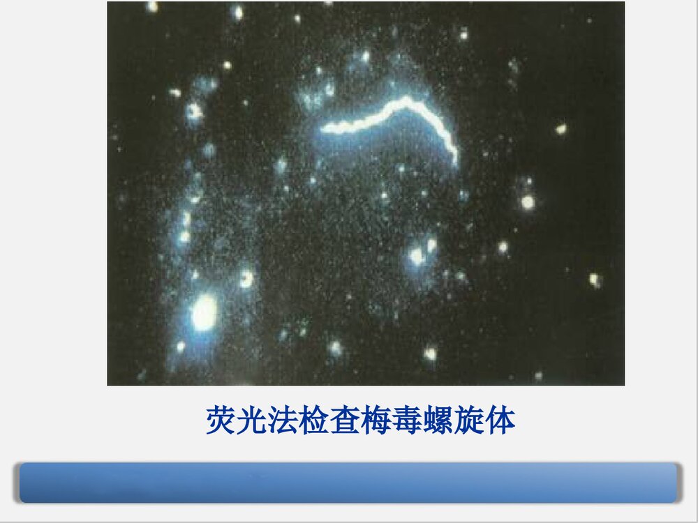 梅毒的诊断与治疗PPT课件下载(共90页·可编辑修改)6