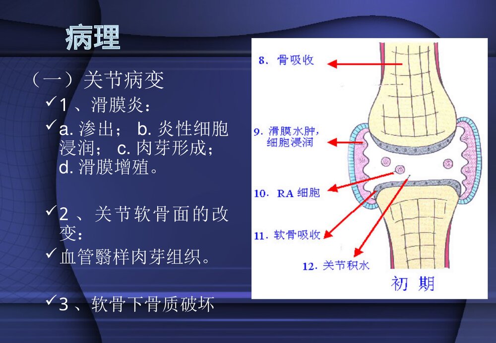类风湿性关节炎PPT课件5
