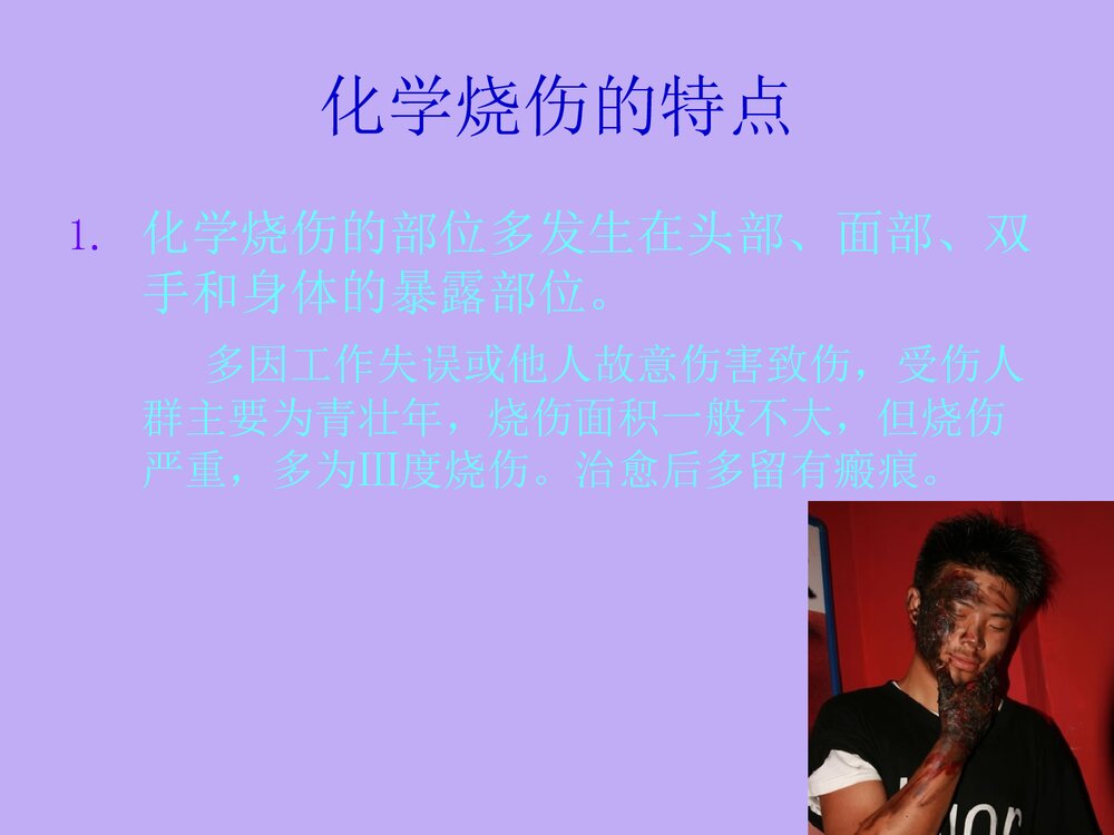 化学烧伤PPT课件下载(共27页)3