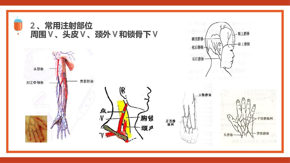 静脉输液PPT课件(共44页·内容可编辑修改)9