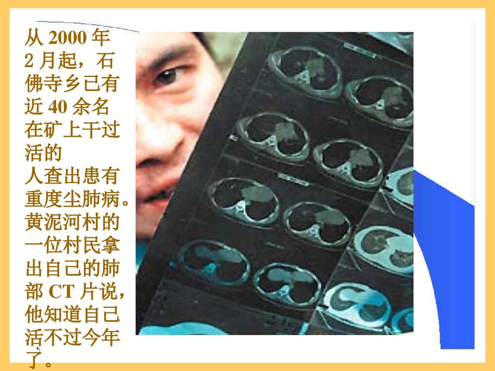 粉尘与尘肺PPT课件下载(共103页)10