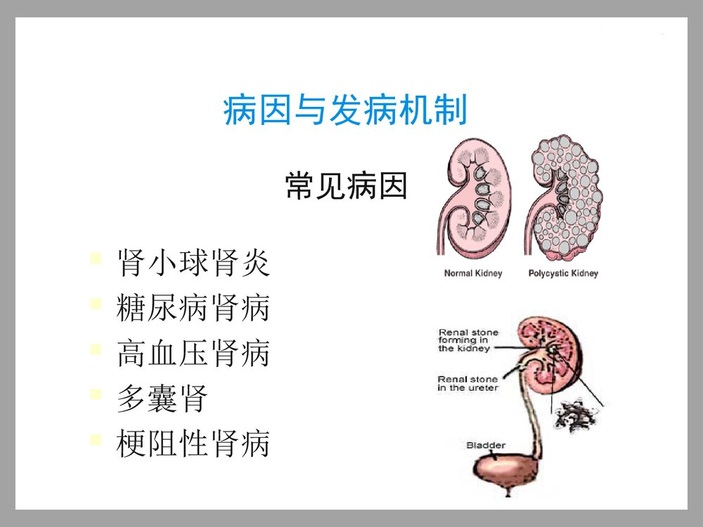 中药灌肠治疗慢性肾衰竭PPT课件下载3