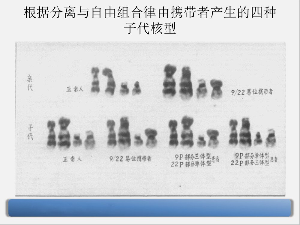 9号染色体三体嵌合型综合症PPT课件下载10