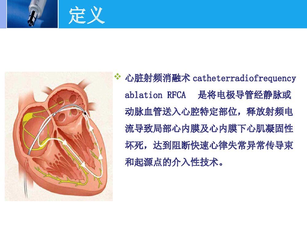 射频消融术的护理PPT课件下载(共22页)3