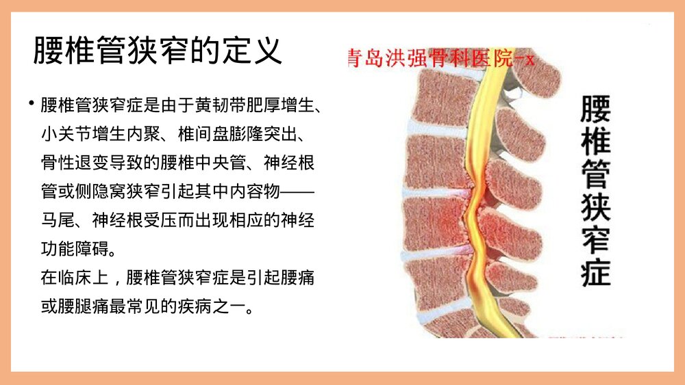 腰椎管狭窄护理PPT课件(共37页·可编辑修改)5