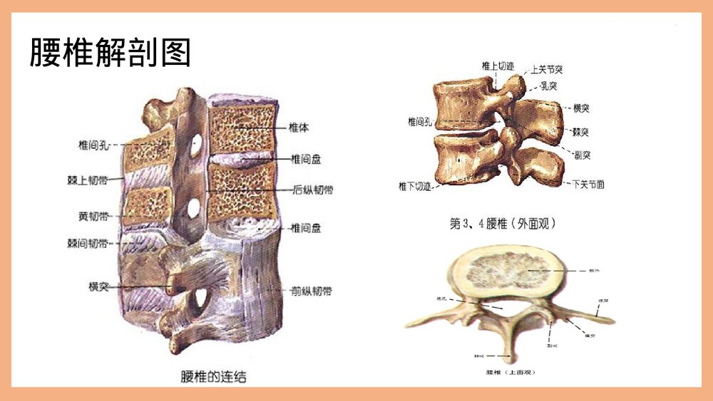 腰椎管狭窄护理PPT课件(共37页·可编辑修改)6