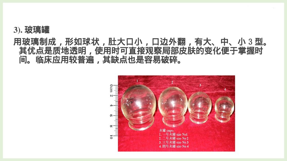 中医技术拔罐法PPT课件下载6