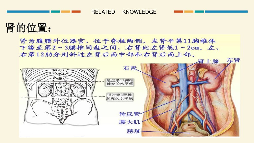 经皮肾镜超声碎石取石手术护理查房PPT课件8
