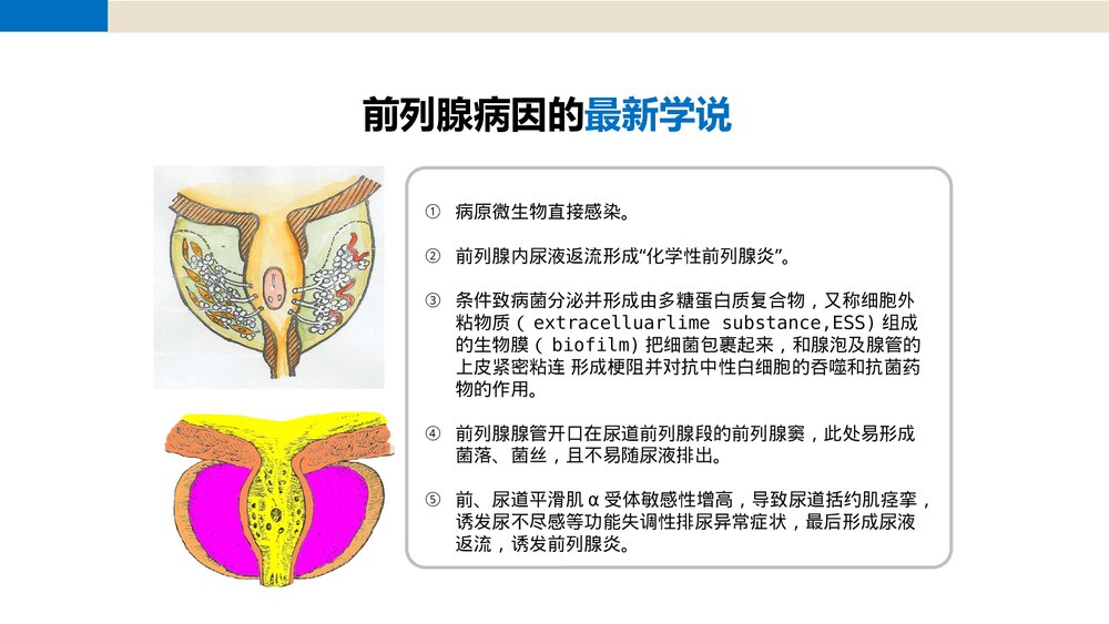 前列腺尿道注药冲洗引流导管技术PPT课件8