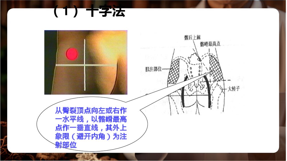 皮下、皮内、肌肉注射PPT课件下载5